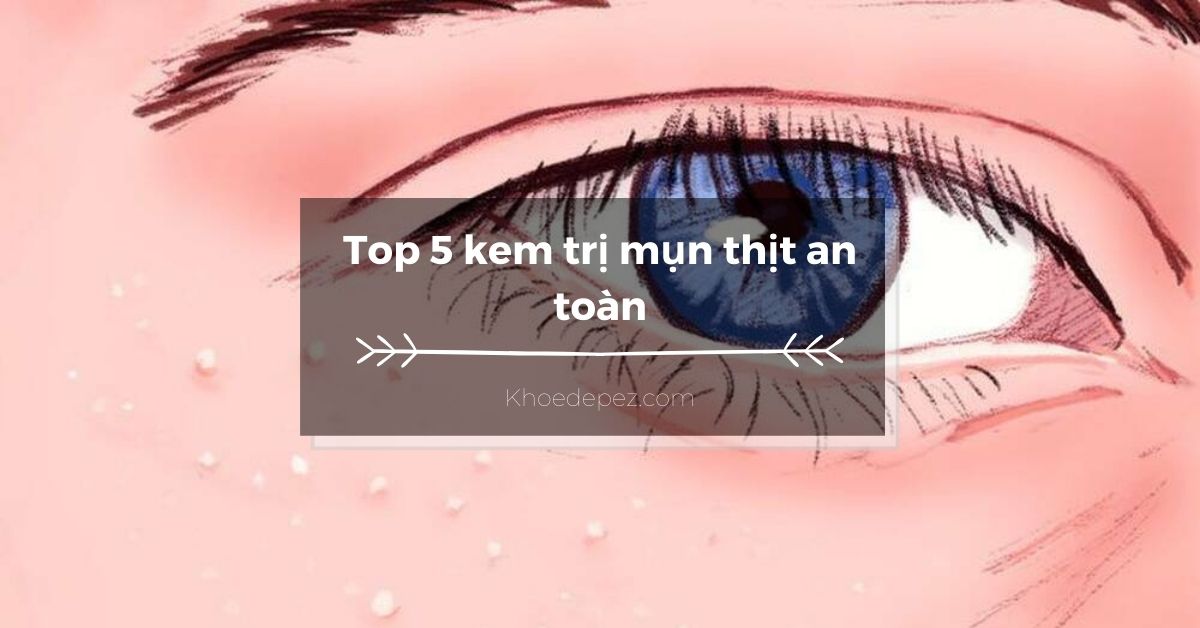 Top kem trị mụn thịt