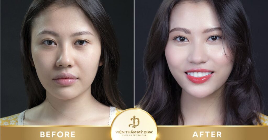 Phun môi collagen  Công nghệ phun môi mới nhất Hàn Quốc 2019  Gà Lips